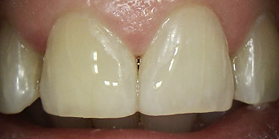Image for 