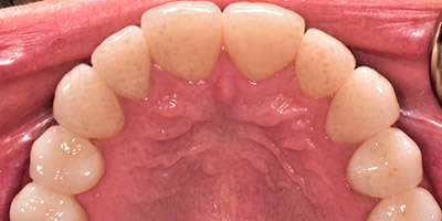 Image for 