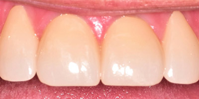 Image for 