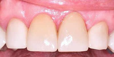 Image for 