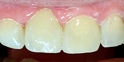 Image for 