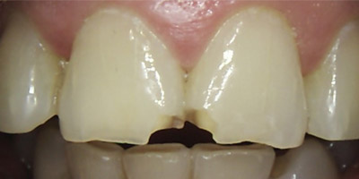 Image for 