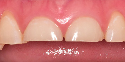 Image for 