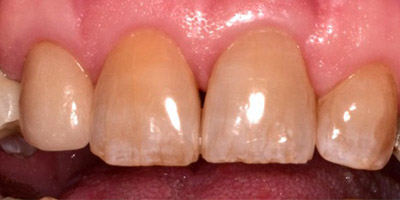 Image for 